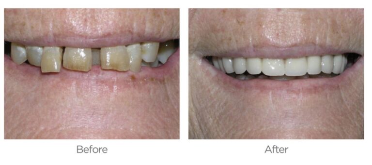 San Diego Dentist 768x342