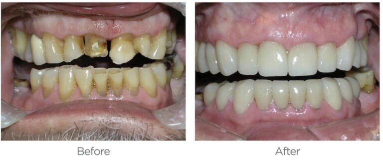 Sedation Dentistry 768x331