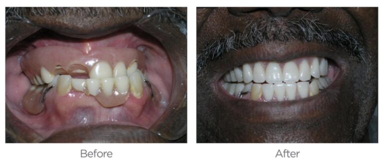 Smile Makeovers 768x335